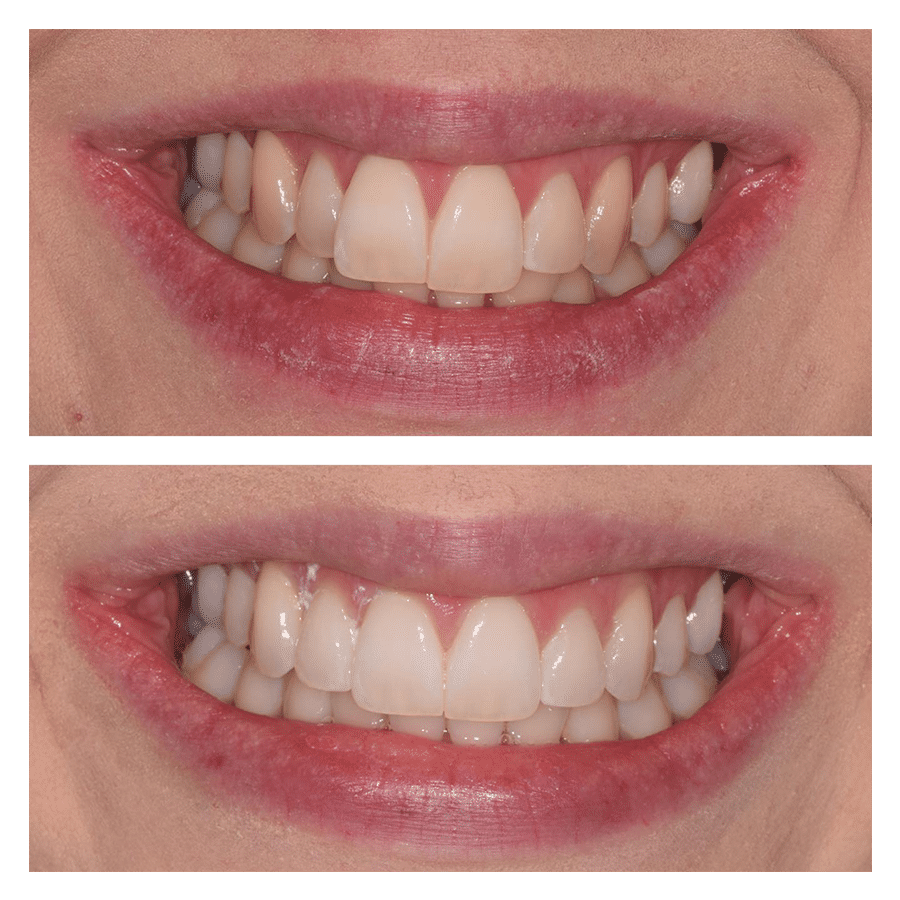 Bank House Dental | Comparison
