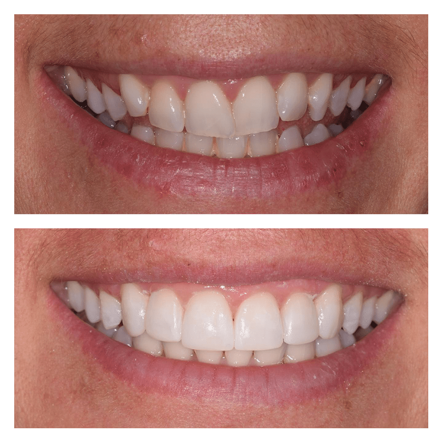 Bank House Dental | Comparison