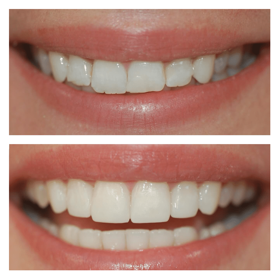 Bank House Dental | Comparison